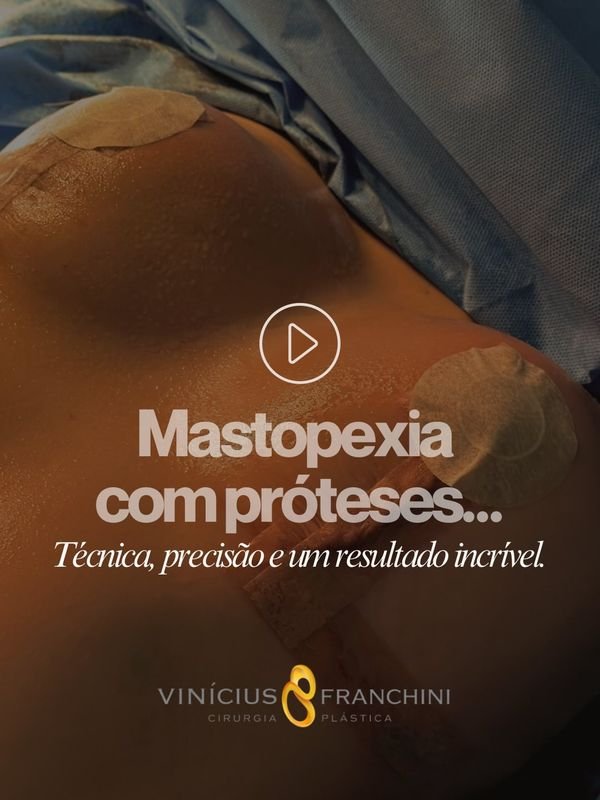 Mastopexia