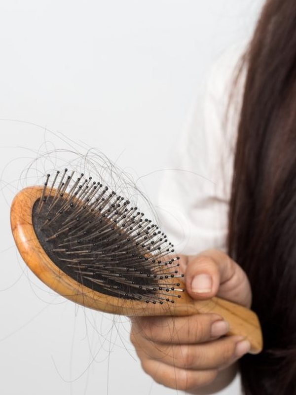 Queda de Cabelo